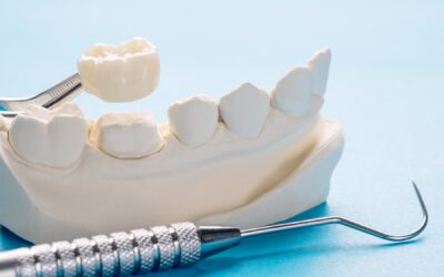 Crowns & Bridges: Reliable Solutions for Damaged Teeth