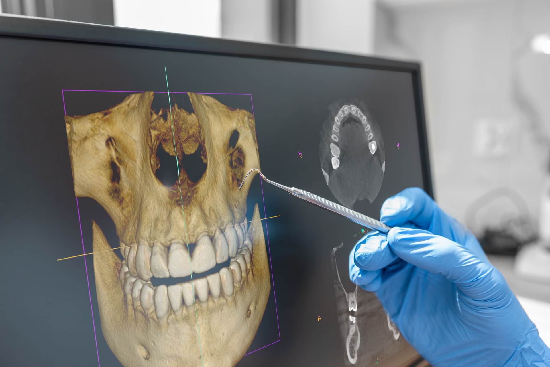 CT Imaging in Dentistry: Why 3D Scans Improve Results